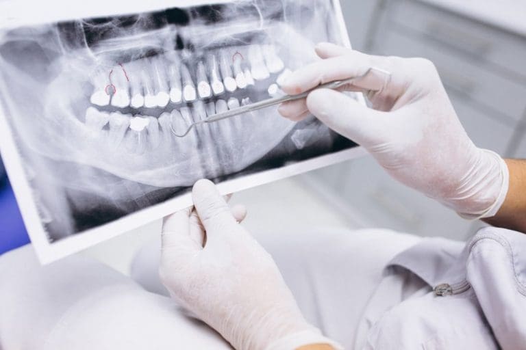 Periodontist Manassas | Dentist observing an x-ray.