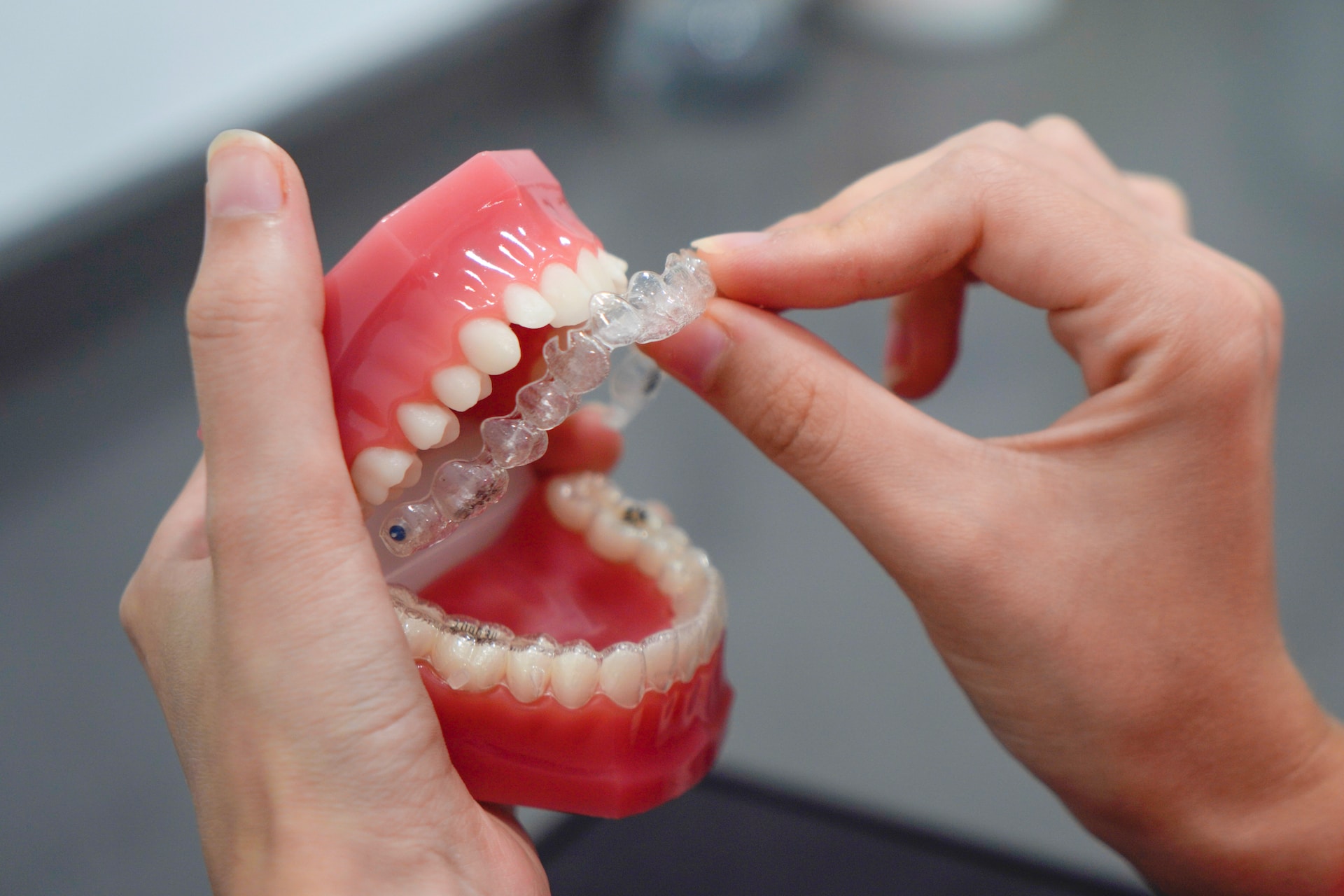 The Advantages and Process of Invisalign Treatment for a Straighter Smile
