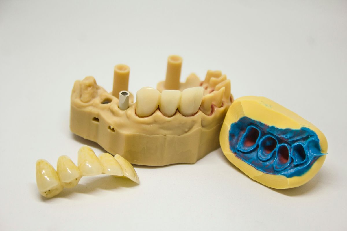 Understanding Invisalign: A Modern Approach to Orthodontics